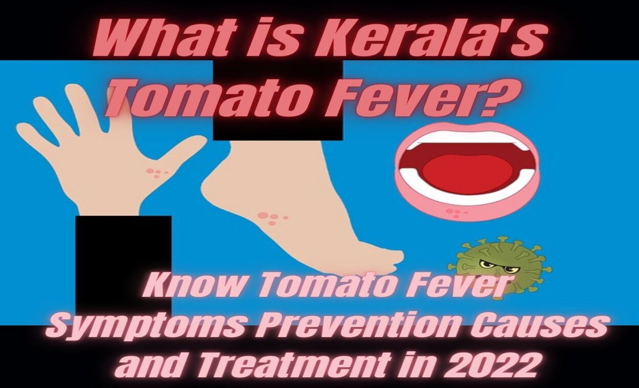 Tomato Fever Symptoms indianmemoir.com